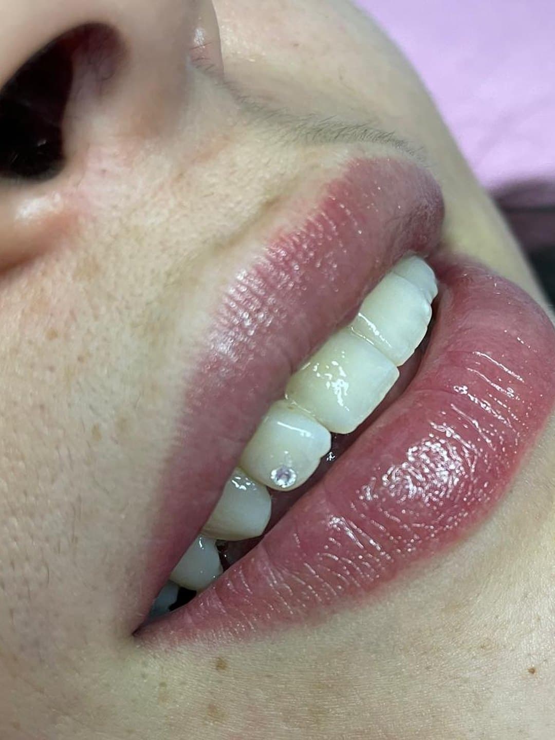 Gema dental básica
